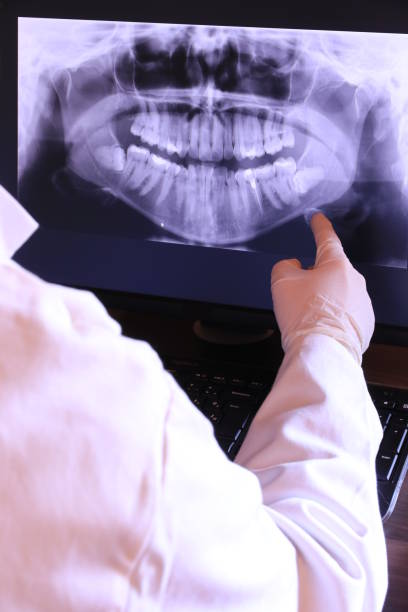 Best Emergency Tooth Extraction in Jackson, MI