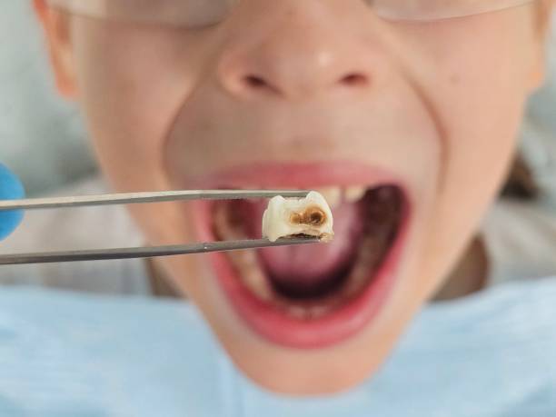 Best Emergency Root Canal Treatment in Jackson, MI